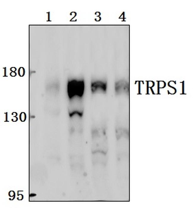 TRPS1 Antibody in Western Blot (WB)