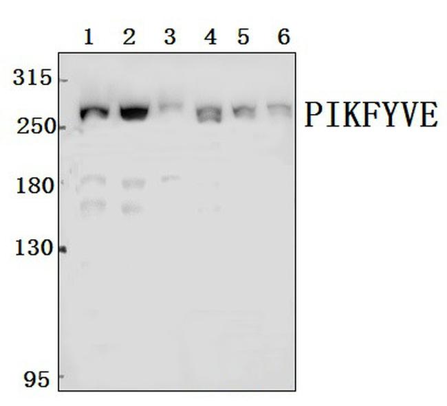 PIKFYVE Antibody in Western Blot (WB)