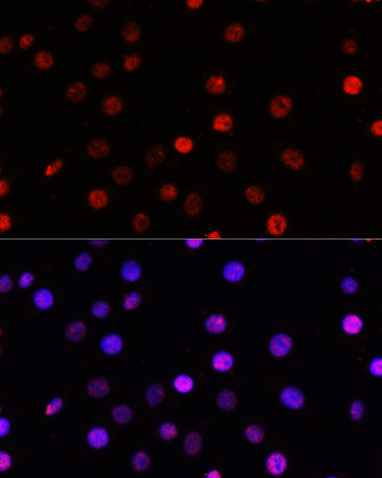 TCF4 Antibody in Immunocytochemistry (ICC/IF)