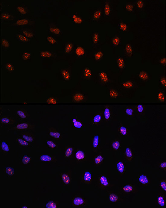 TCF4 Antibody in Immunocytochemistry (ICC/IF)