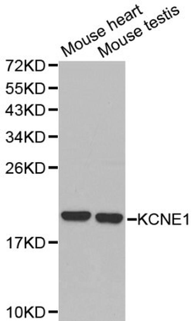 KCNE1 Antibody in Western Blot (WB)