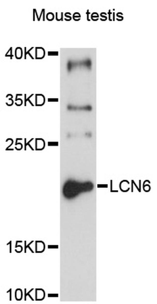 LCN6 Antibody in Western Blot (WB)