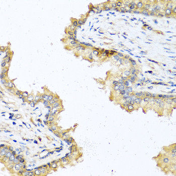 DEFB121 Antibody in Immunohistochemistry (Paraffin) (IHC (P))