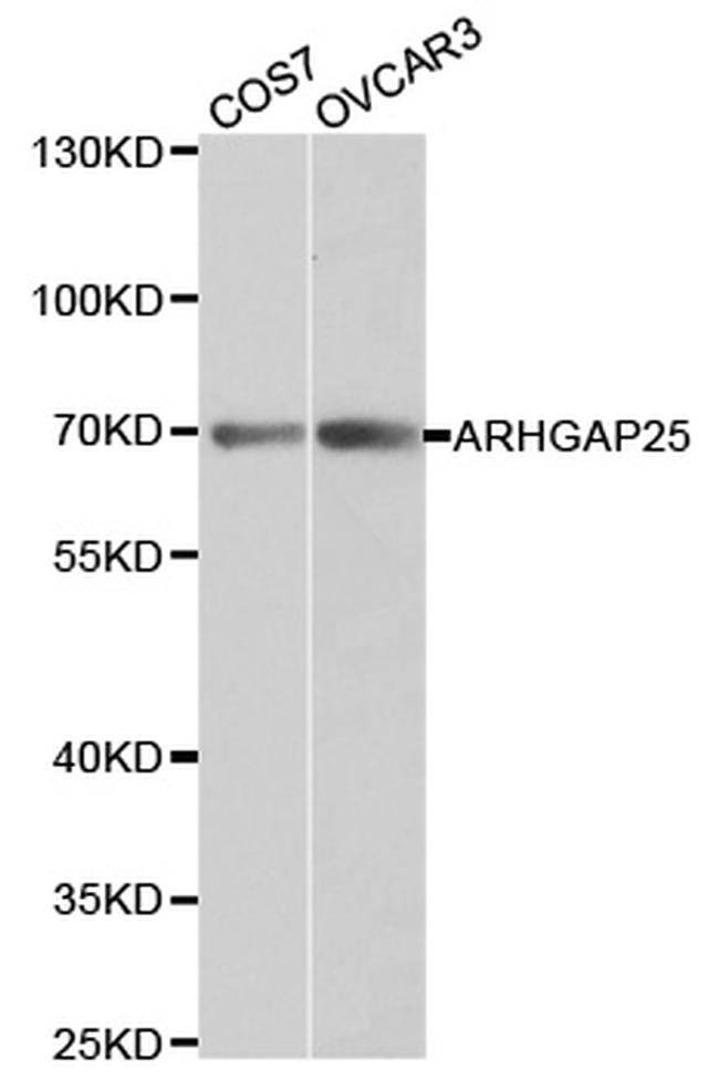 ARHGAP25 Antibody in Western Blot (WB)