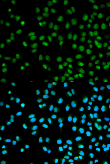 Cystatin 8 Antibody in Immunocytochemistry (ICC/IF)