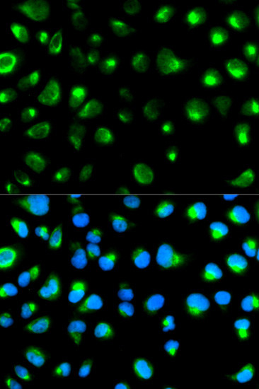 GYPC Antibody in Immunocytochemistry (ICC/IF)