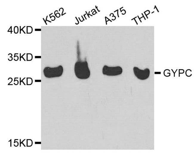 GYPC Antibody in Western Blot (WB)