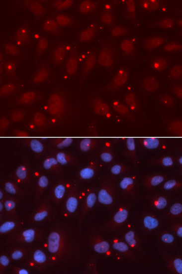 XRCC3 Antibody in Immunocytochemistry (ICC/IF)