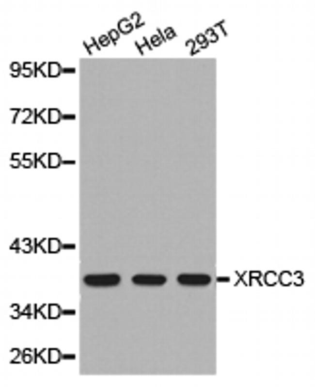 XRCC3 Antibody in Western Blot (WB)