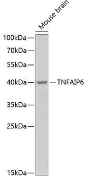 TNFAIP6 Antibody in Western Blot (WB)