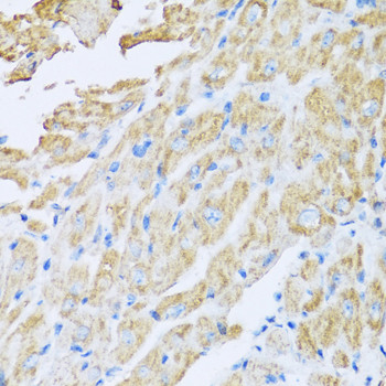 IL18BP Antibody in Immunohistochemistry (Paraffin) (IHC (P))