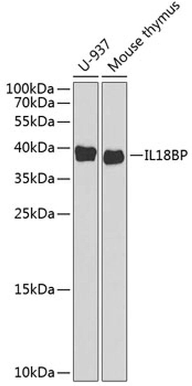 IL18BP Antibody in Western Blot (WB)