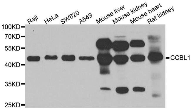 CCBL1 Antibody in Western Blot (WB)