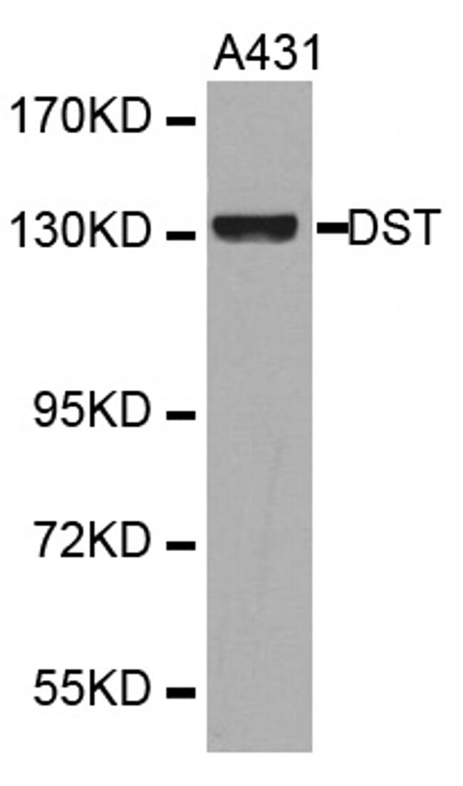 DST Antibody in Western Blot (WB)