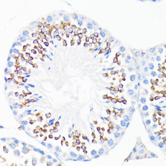 Cathelicidin Antibody in Immunohistochemistry (Paraffin) (IHC (P))