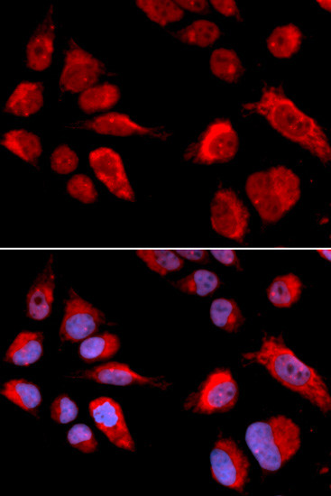 CBS Antibody in Immunocytochemistry (ICC/IF)