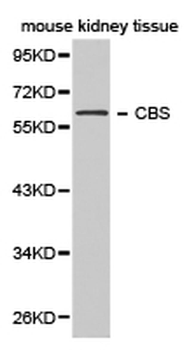 CBS Antibody in Western Blot (WB)