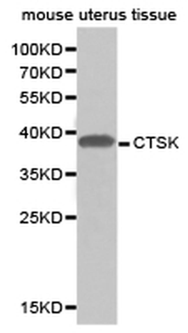 Cathepsin K Antibody in Western Blot (WB)