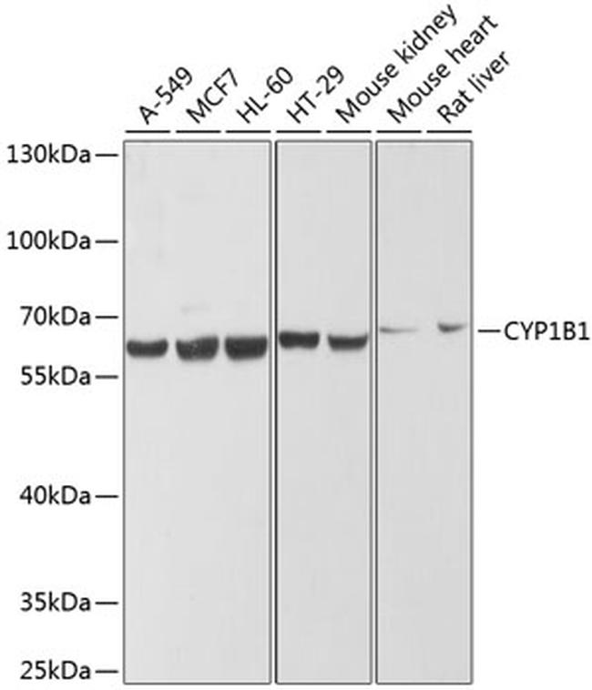 CYP1B1 Antibody in Western Blot (WB)