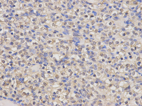 HMOX1 Antibody in Immunohistochemistry (Paraffin) (IHC (P))