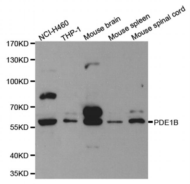 PDE1B Antibody in Western Blot (WB)