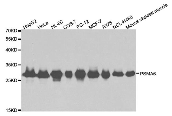 PSMA6 Antibody in Western Blot (WB)