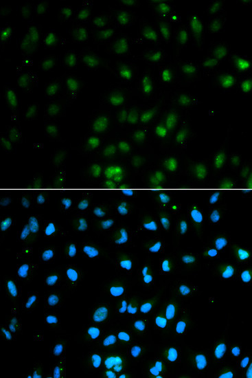 PTPN2 Antibody in Immunocytochemistry (ICC/IF)