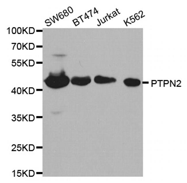 PTPN2 Antibody in Western Blot (WB)