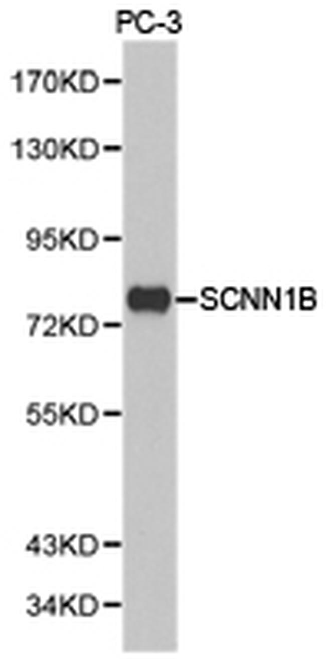 SCNN1B Antibody in Western Blot (WB)