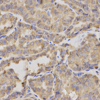 XRCC2 Antibody in Immunohistochemistry (Paraffin) (IHC (P))