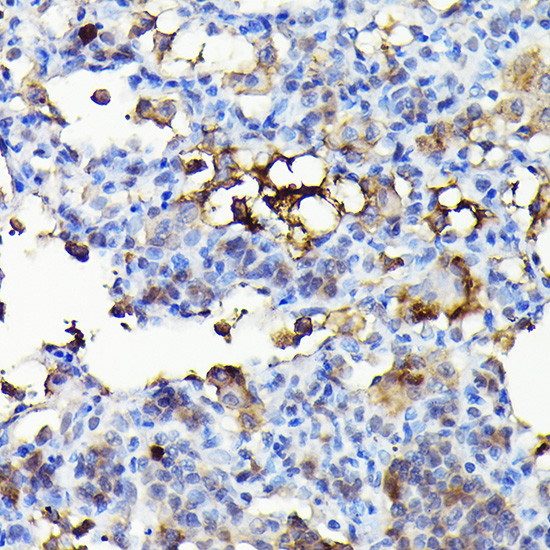 NOX4 Antibody in Immunohistochemistry (Paraffin) (IHC (P))