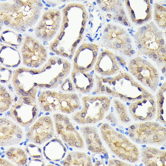 NOX4 Antibody in Immunohistochemistry (Paraffin) (IHC (P))