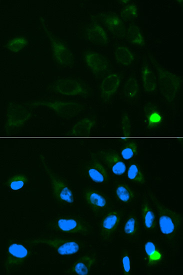 UGT1A9 Antibody in Immunocytochemistry (ICC/IF)