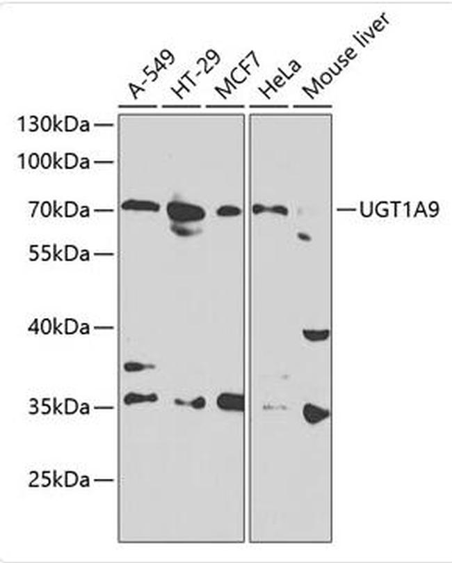 UGT1A9 Antibody in Western Blot (WB)