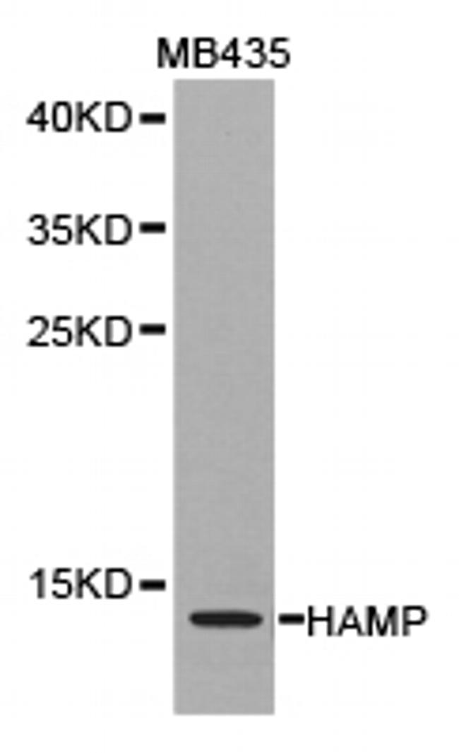 HAMP Antibody in Western Blot (WB)