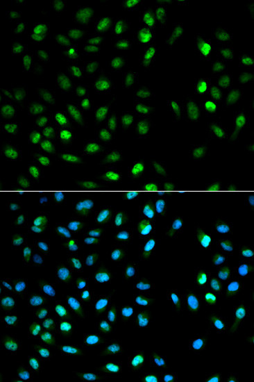 DTNBP1 Antibody in Immunocytochemistry (ICC/IF)