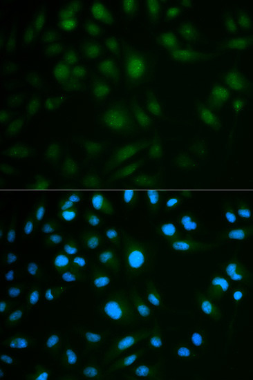 IL23R Antibody in Immunocytochemistry (ICC/IF)