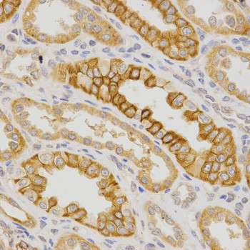 IL23R Antibody in Immunohistochemistry (Paraffin) (IHC (P))