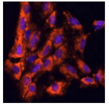 IL-18 Antibody in Immunocytochemistry (ICC/IF)