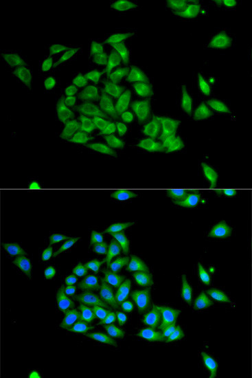 PICK1 Antibody in Immunocytochemistry (ICC/IF)