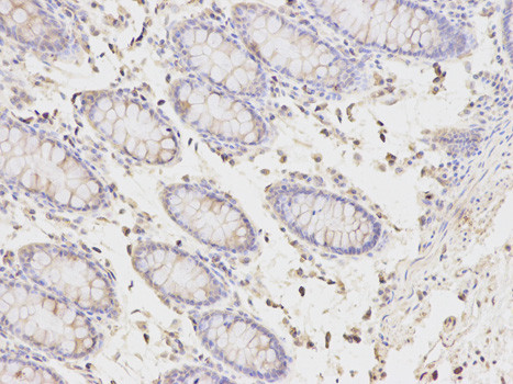 PICK1 Antibody in Immunohistochemistry (Paraffin) (IHC (P))