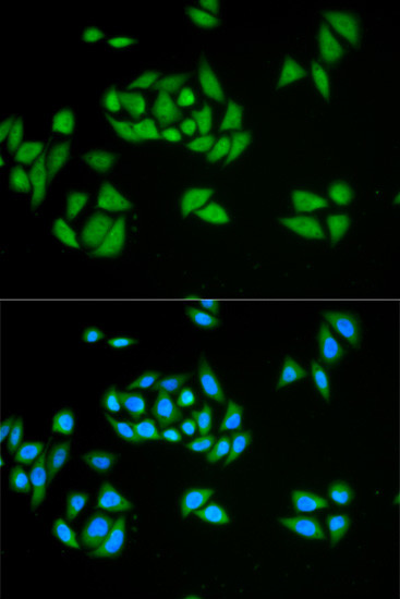 UPF1 Antibody in Immunocytochemistry (ICC/IF)