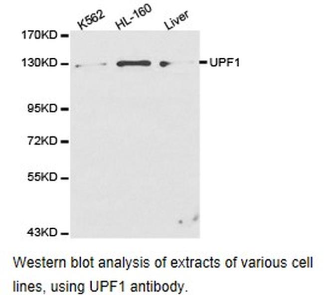 UPF1 Antibody in Western Blot (WB)