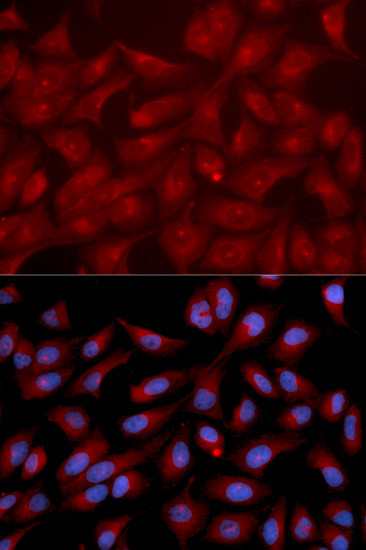 RAPGEF3 Antibody in Immunocytochemistry (ICC/IF)