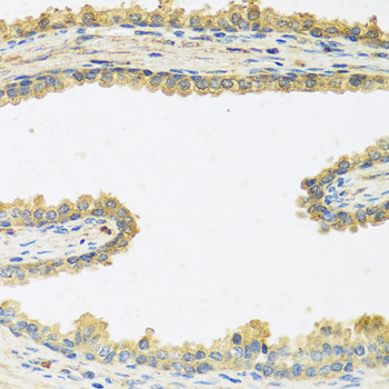 CRHBP Antibody in Immunohistochemistry (Paraffin) (IHC (P))