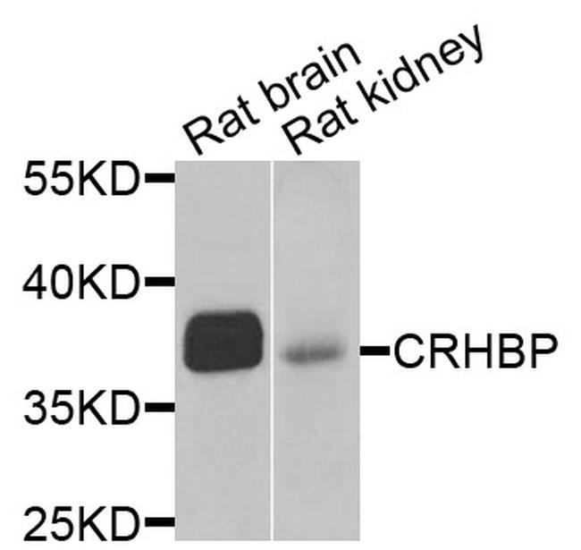 CRHBP Antibody in Western Blot (WB)