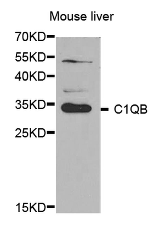 C1QB Antibody in Western Blot (WB)