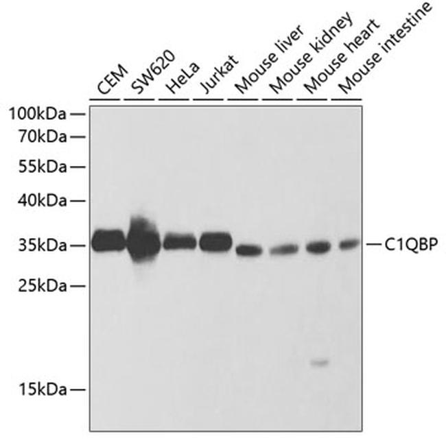 C1QBP Antibody in Western Blot (WB)