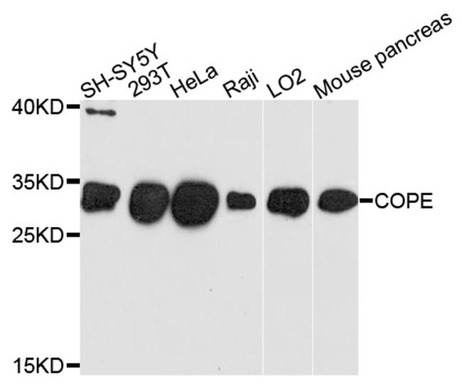 COPE Antibody in Western Blot (WB)