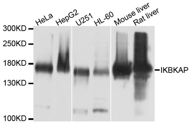 IKAP Antibody in Western Blot (WB)